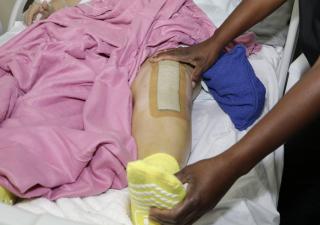 Operation Walk beneficia a más de 50 pacientes de escasos recursos