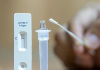 Minsa: No se registran defunciones por Covid-19 en la última semana epidemiológica