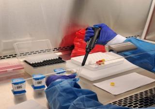 Panamá acelera respuesta, tratamiento y diagnóstico de la tuberculosis (TB)