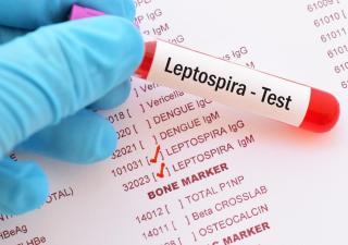 Mantener limpio el entorno ayuda a evitar la leptospirosis 