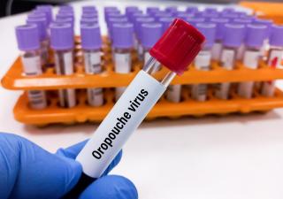 Acciones de la población clave para reducir casos del virus Oropouche