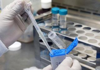 Tratamientos en Panamá contra la tuberculosis son efectivos en la cepa Beijing