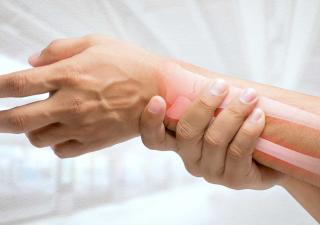 Sana alimentación y actividad física para prevenir la osteoporosis