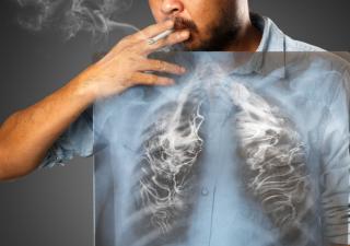 En Panamá fortalecerán estrategias para disminuir muertes por tabaco en el mundo 
