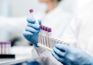 Ante registro de nuevos casos del virus Oropouche instan a la población reforzar medidas de prevención