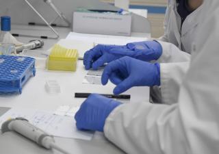 Minsa reporta 5 nuevos casos de viruela símica 