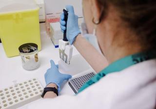 Se detecta tercer caso de la viruela símica en Panamá