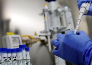 Panamá no registra casos sospechosos de viruela del mono