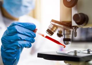 Minsa reitera recomendaciones para evitar contagios por el virus Oropouche