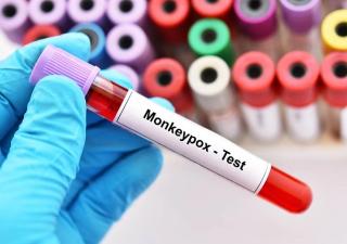 Se extiende uso de vacuna contra la Viruela del Mono (Mpox)