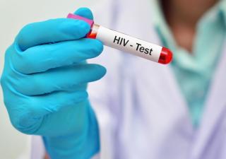 Minsa intensifica estrategias para disminuir prevalencia  de VIH en el país 